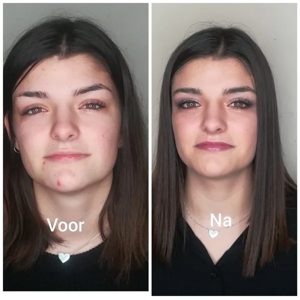 Voor & Na